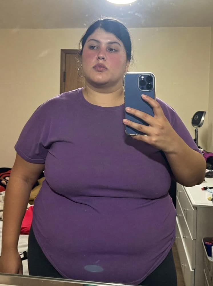 Patient story — -24 lbs